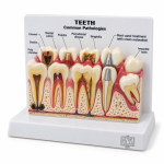 Teeth Model with Description Plate
